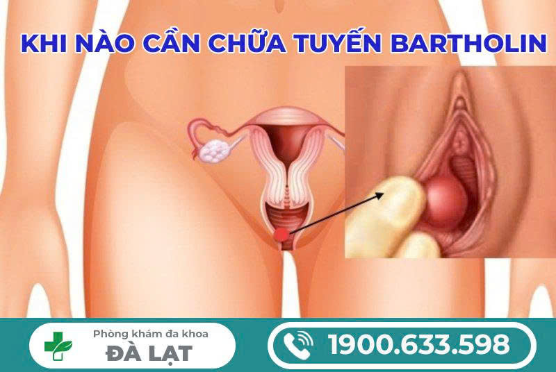 Hình ảnh minh họa